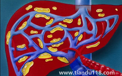 肝代謝不好吃什么調(diào)理(肝代謝不好有什么癥狀)(圖4) 肝代謝不好吃什么調(diào)理4
