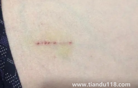 被貓抓了一下輕微破皮要打針嗎(被貓抓傷多少天過(guò)危險(xiǎn)期)(圖1) 被貓抓了一下輕微破皮要打針嗎1