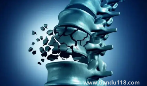 骨質(zhì)疏松癥也叫靜悄悄的流行病(骨質(zhì)疏松吃什么食物可以改善)(圖1) 骨質(zhì)疏松癥也叫靜悄悄的流行病1